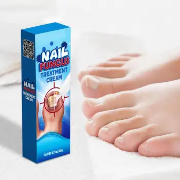 Восстанавливающий крем для ног 0,71 унции Эффективный Крем для обновления ногтей на ногах Натуральный Бальзам повышенной прочности для обесцвеченных ногтей Изображение 2